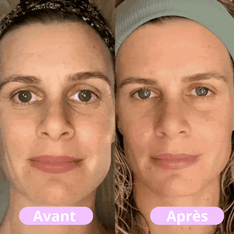 Vonroi - Masseur facial LED tonifiant